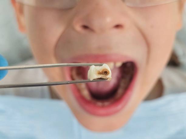 Best Dentist for Dental Trauma  in Wickerham Manor Fisher, PA